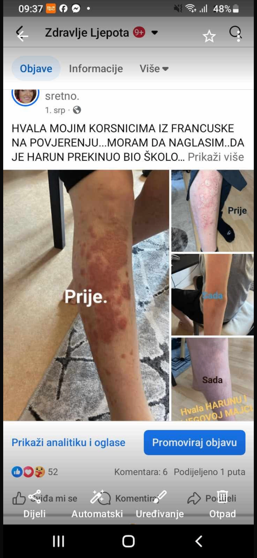 Kožni osip na nogama i rukama — prije i poslije