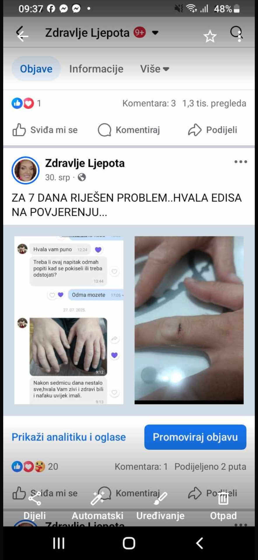 Zarastanje rane na prstu — 7 dana